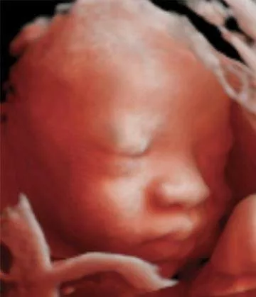 25 Echographie 3d Bebe 4 Mois Echographie 3d Bebe 4 Mois